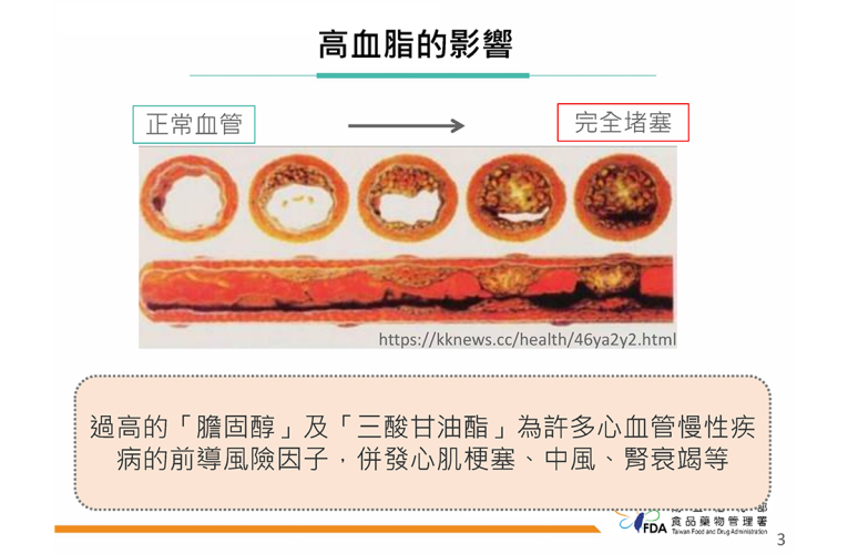 降血脂藥吃對了嗎？食藥署：四類降血脂藥一次解析